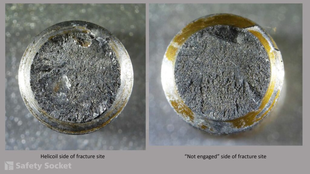site of fractures on different sockets